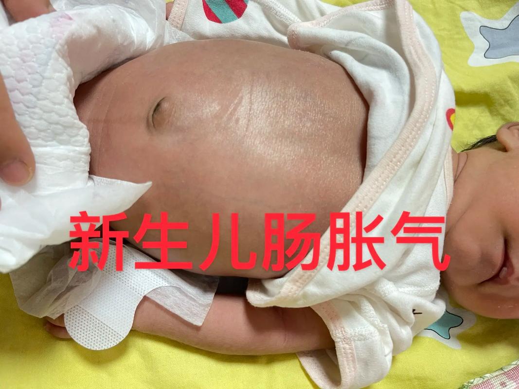 新生儿20天涨7两是正常发育速度吗？需要关注喂养方式吗？-第1张图片-郑州医学网