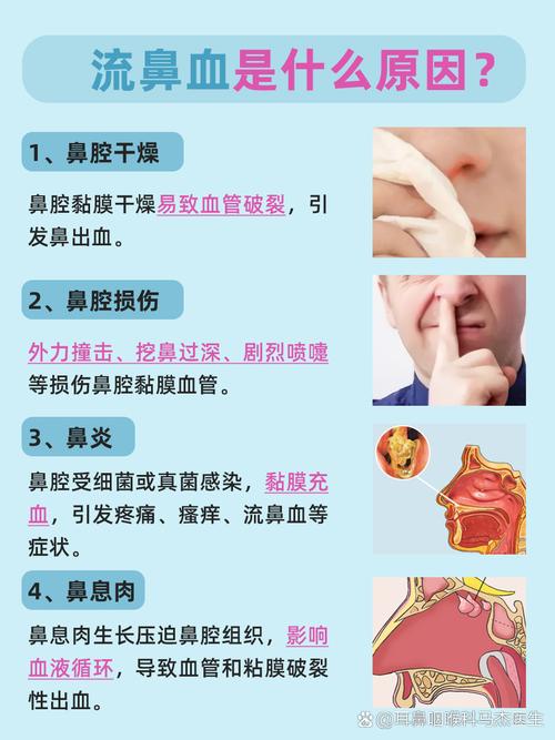 孕期鼻子干出血怎么办-第1张图片-郑州医学网