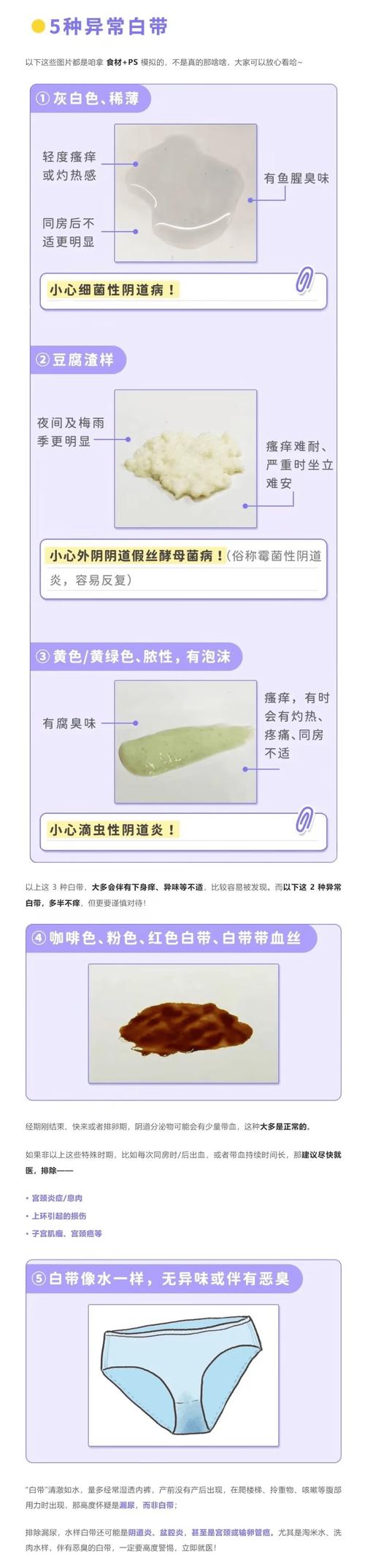 孕期分泌物颜色异常是疾病信号吗？不同颜色代表什么健康问题？-第1张图片-郑州医学网