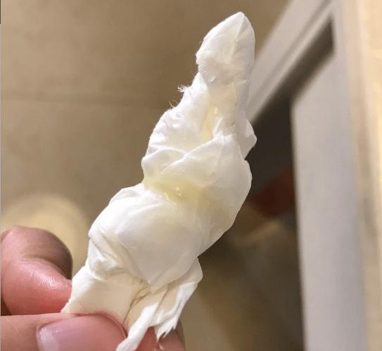 孕期分泌物颜色异常是疾病信号吗？不同颜色代表什么健康问题？-第2张图片-郑州医学网