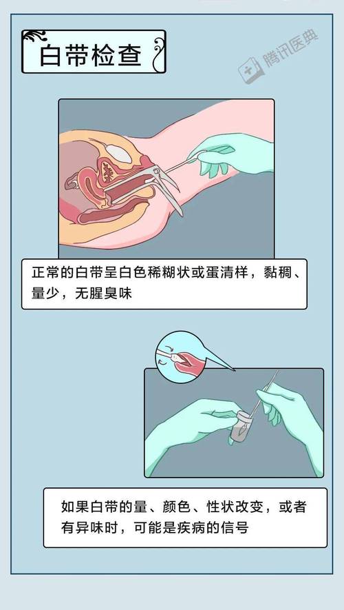 孕期分泌物颜色异常是疾病信号吗？不同颜色代表什么健康问题？-第3张图片-郑州医学网
