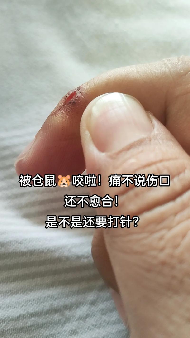 孕期被仓鼠咬了会不会影响胎儿?需要打针吗?-第2张图片-郑州医学网 孕期被仓鼠咬了会不会影响胎儿?需要打针吗?-第2张图片-郑州医学网