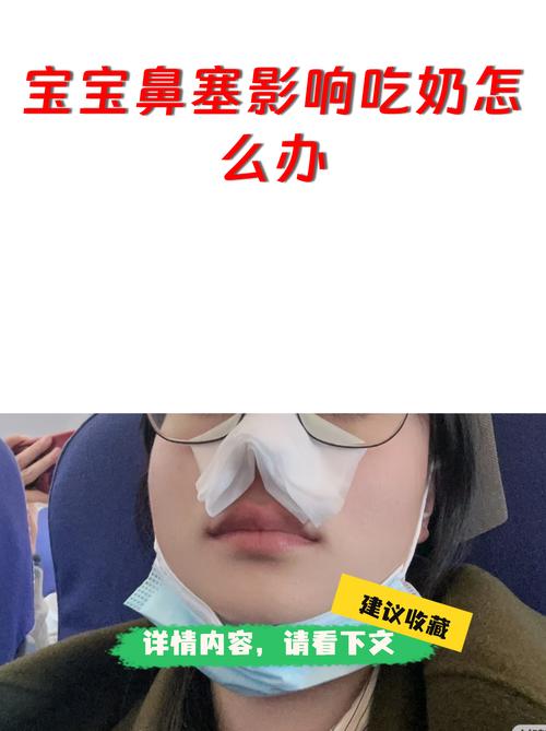 新生儿鼻塞喘气困难怎么办？需要紧急处理吗？-第3张图片-郑州医学网