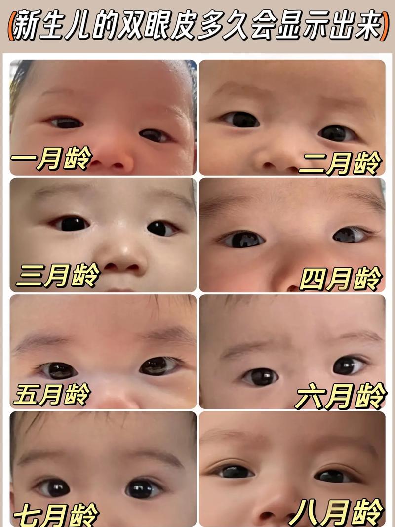 新生儿眼睛是不是都小?为什么有些宝宝眼睛大,有些却偏小?-第1张图片-郑州医学网 新生儿眼睛是不是都小?为什么有些宝宝眼睛大,有些却偏小?-第1张图片-郑州医学网