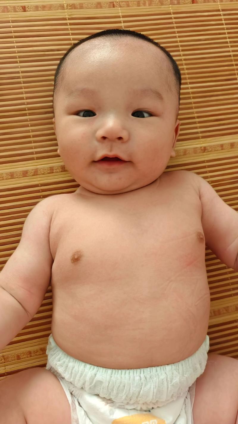 新生儿眼睛是不是都小?为什么有些宝宝眼睛大,有些却偏小?-第3张图片-郑州医学网 新生儿眼睛是不是都小?为什么有些宝宝眼睛大,有些却偏小?-第3张图片-郑州医学网