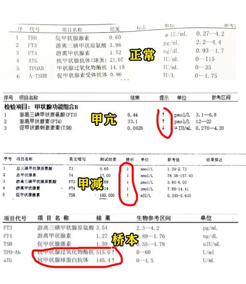 孕期甲状腺素检查什么-第1张图片-郑州医学网