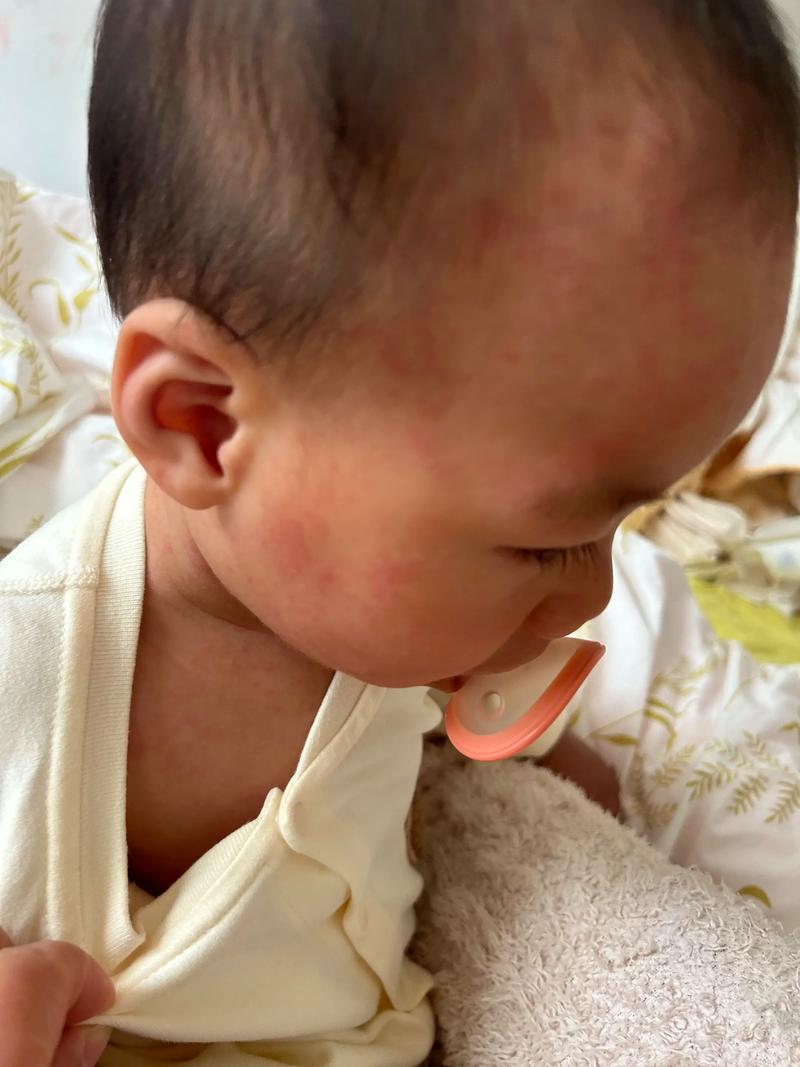 新生儿心肌炎早期症状隐匿，家长该如何捕捉这些不易察觉的信号？-第2张图片-郑州医学网