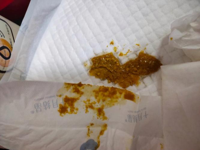 新生儿吃母乳后拉肚子，是母乳问题还是宝宝不适应？-第1张图片-郑州医学网