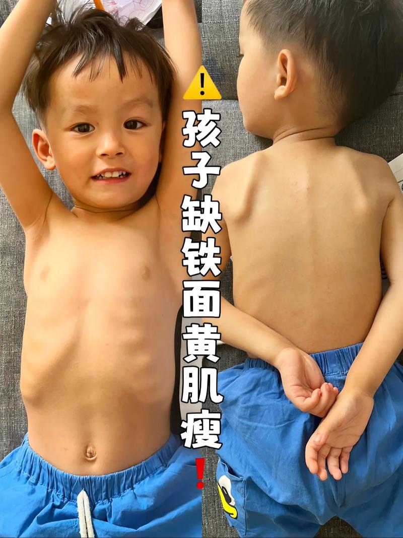 儿童缺铜会引发哪些健康问题？症状表现与影响有哪些？-第1张图片-郑州医学网