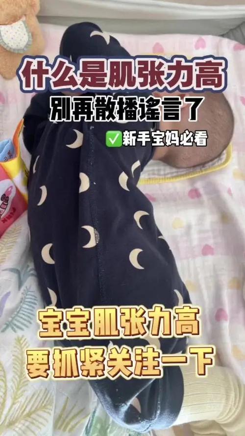 新生儿吃奶时打挺头后仰是正常现象还是健康预警？-第2张图片-郑州医学网