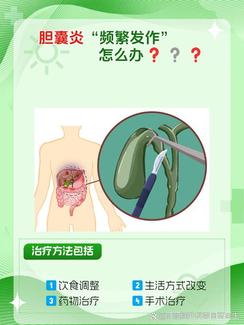 儿童胆管炎有哪些典型症状？最佳治疗方案是什么？-第1张图片-郑州医学网