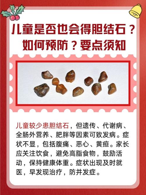 儿童胆管炎有哪些典型症状？最佳治疗方案是什么？-第2张图片-郑州医学网