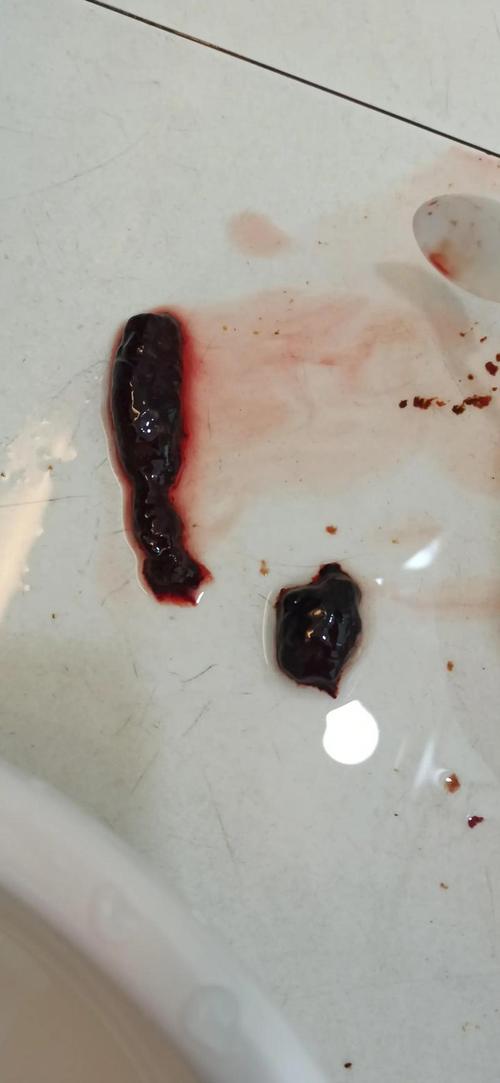 孕期子宫内膜脱落图片正常吗?会对胎儿有影响吗?-第3张图片-郑州医学网 孕期子宫内膜脱落图片正常吗?会对胎儿有影响吗?-第3张图片-郑州医学网