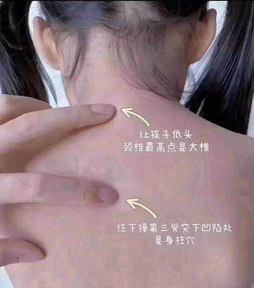 儿童身柱穴到底在背部第几椎棘突下？附精准定位图与取穴技巧-第2张图片-郑州医学网