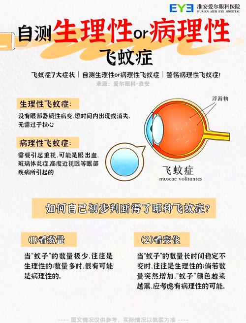 儿童飞蚊症是正常生理现象还是疾病信号?诱因有哪些?需警惕哪些眼部问题?-第2张图片-郑州医学网 儿童飞蚊症是正常生理现象还是疾病信号?诱因有哪些?需警惕哪些眼部问题?-第2张图片-郑州医学网