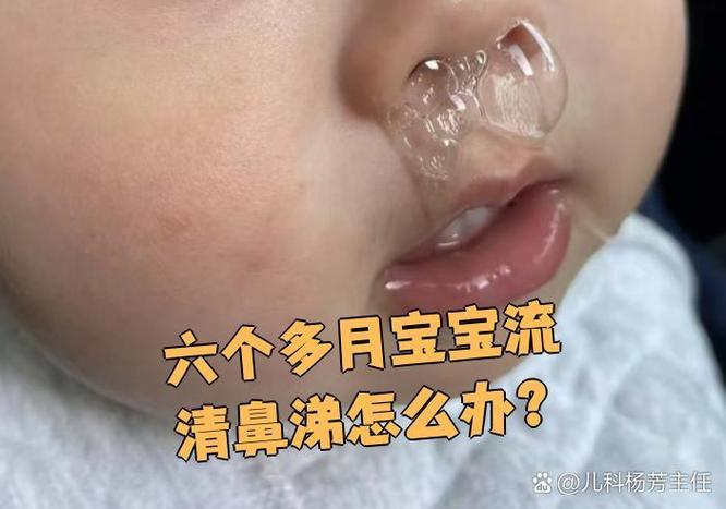 新生儿流鼻涕到底能不能自愈？家长需要怎么护理才正确？-第2张图片-郑州医学网