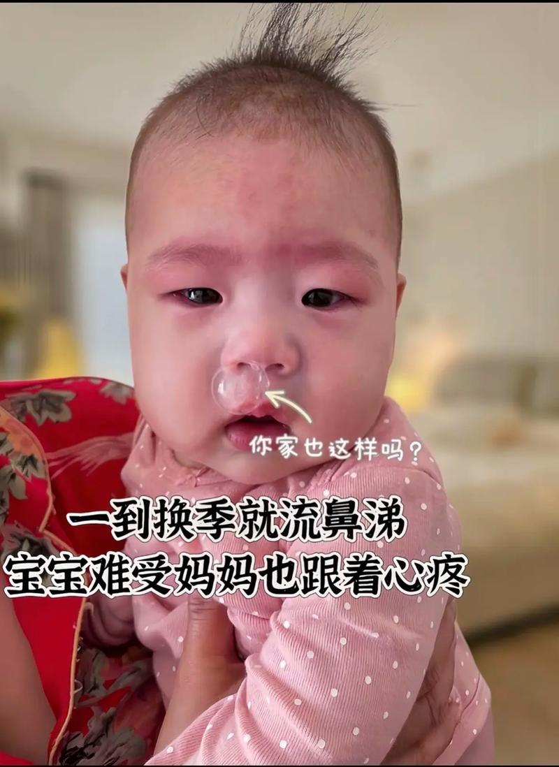 新生儿流鼻涕到底能不能自愈？家长需要怎么护理才正确？-第3张图片-郑州医学网