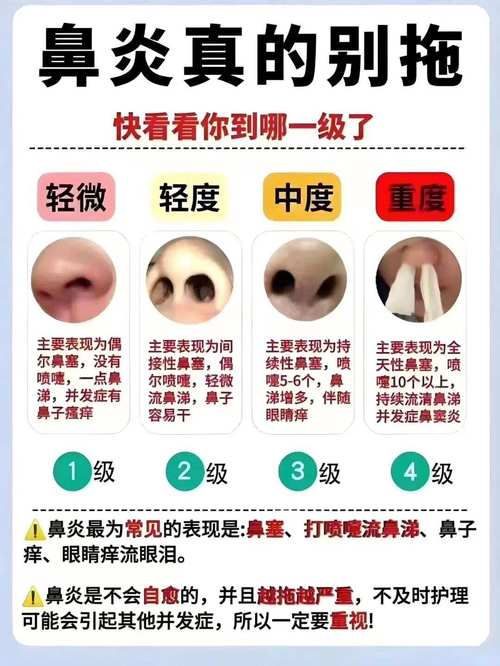 孕期鼻子不通气，到底是谁在捣鬼？激素变化还是其他原因在作祟？-第1张图片-郑州医学网