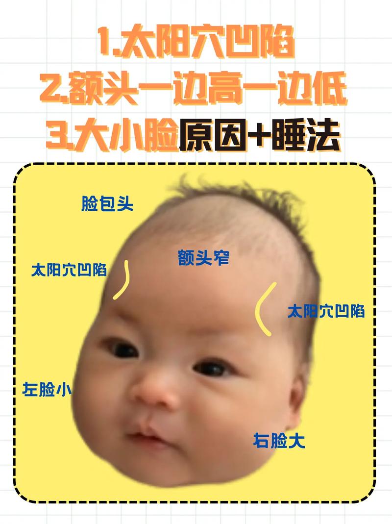 新生儿额头上面有凹陷是正常现象还是异常信号？需要警惕哪些潜在问题？-第1张图片-郑州医学网