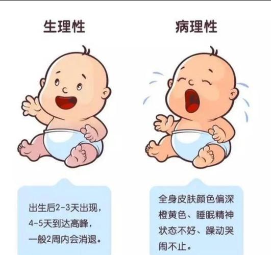 孕期哪些因素会影响宝宝出生后黄疸的出现？-第3张图片-郑州医学网