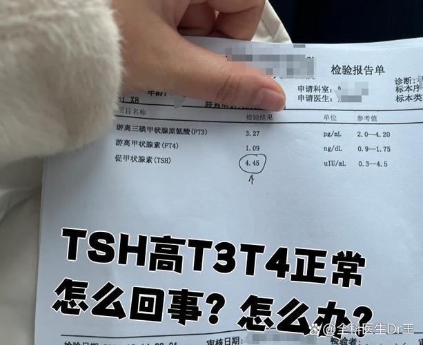 新生儿甲状腺T4偏低会影响发育吗？需要如何干预治疗？-第1张图片-郑州医学网