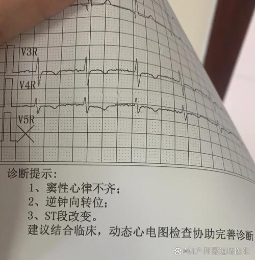 孕期心电图检查具体是查什么的?对胎儿有影响吗?-第1张图片-郑州医学网 孕期心电图检查具体是查什么的?对胎儿有影响吗?-第1张图片-郑州医学网