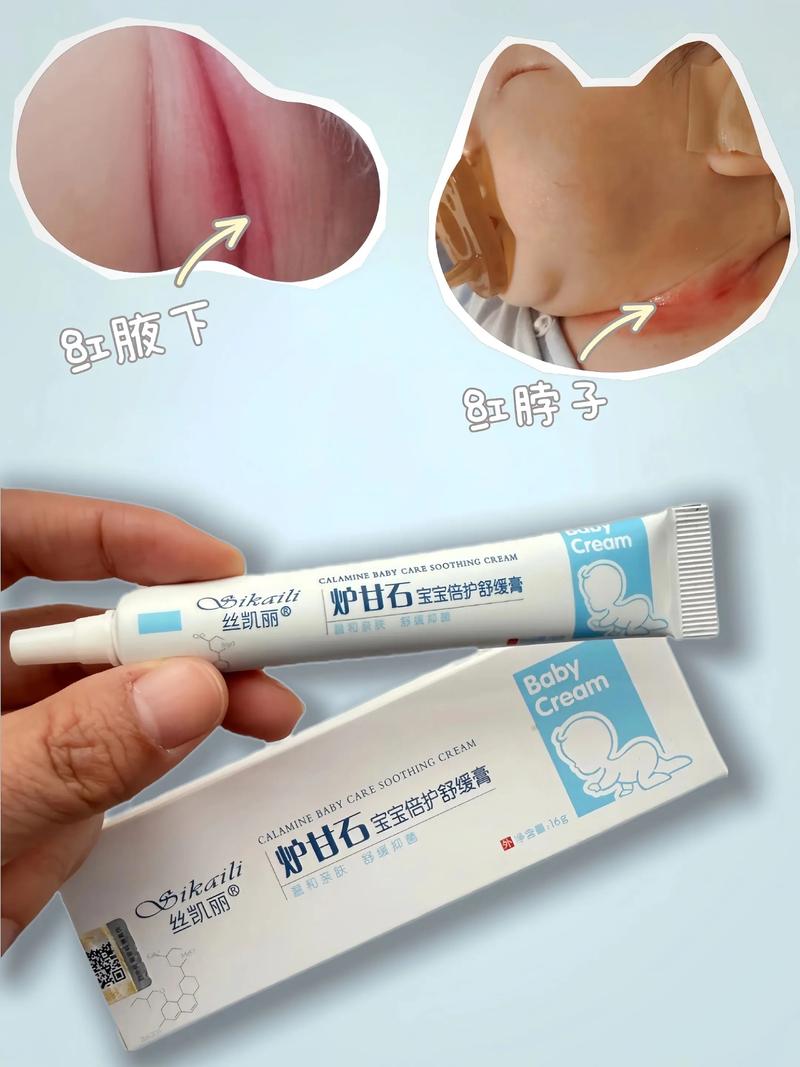 新生儿皮肤娇嫩,擦炉甘石真的安全吗?有没有这些潜在风险?-第2张图片-郑州医学网 新生儿皮肤娇嫩,擦炉甘石真的安全吗?有没有这些潜在风险?-第2张图片-郑州医学网