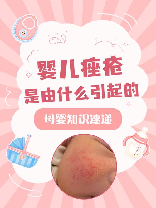 新生儿痤疮必须停母乳吗？不干预会自愈吗？-第2张图片-郑州医学网