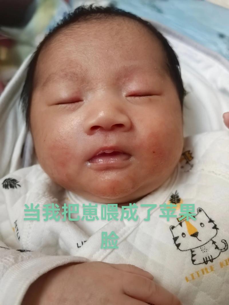 新生儿吐奶呈豆渣状是消化不良还是病理信号？-第3张图片-郑州医学网