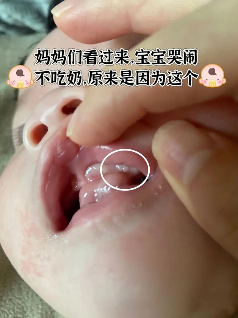 新生儿一哭闹就喝奶，是饿了还是另有原因？-第2张图片-郑州医学网