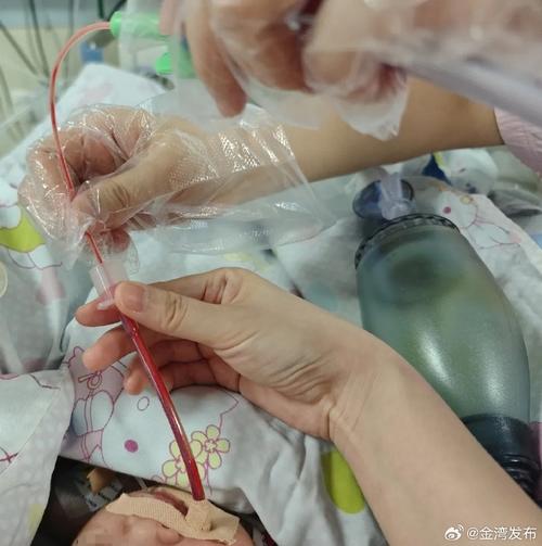 长沙市新生儿肺炎高发，哪些诱因最常见？家长该如何科学预防？-第1张图片-郑州医学网