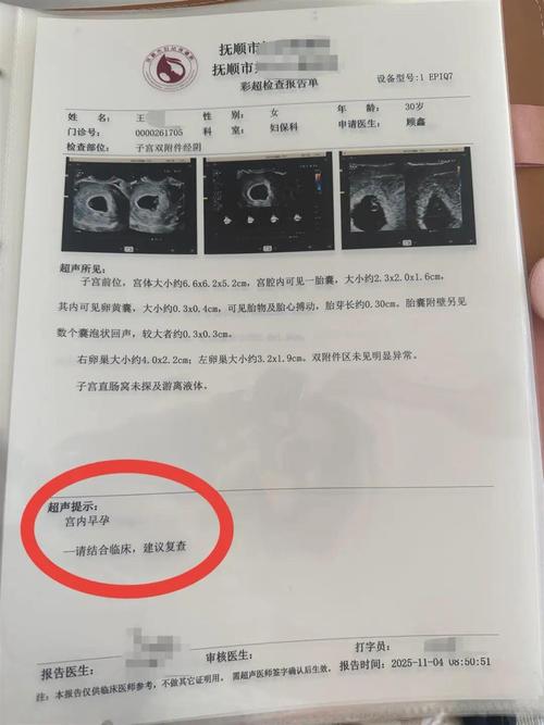 孕妇孕期到底需要做多少次B超才合适？不同阶段有哪些必须检查的项目？-第1张图片-郑州医学网