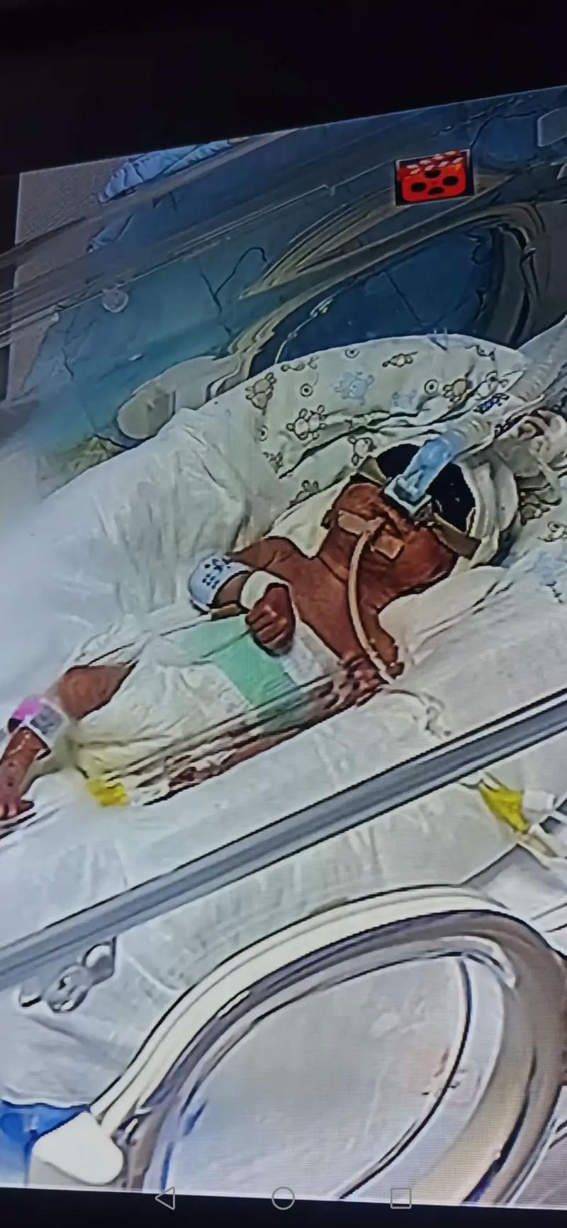 重庆新生儿保温箱费用为何差异大？医保报销比例与自付金额如何计算？-第3张图片-郑州医学网