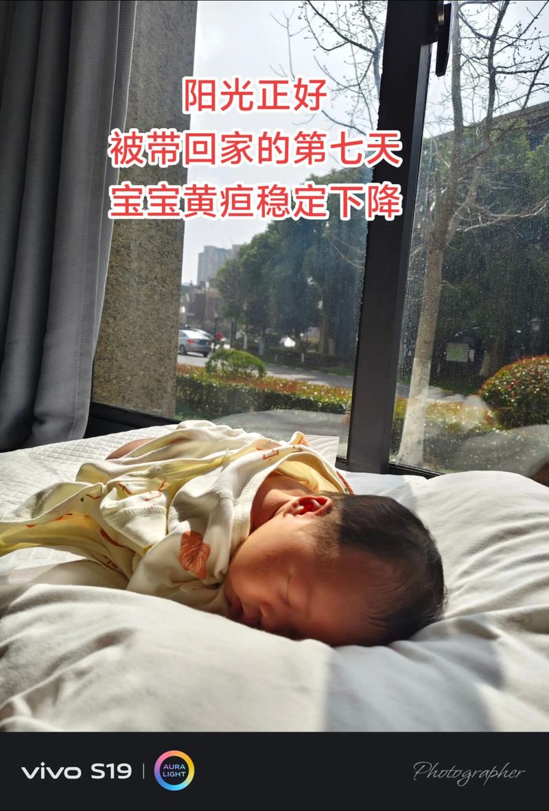 新生儿第7天黄疸21mg/ddl算高吗？需要立即治疗吗？-第1张图片-郑州医学网