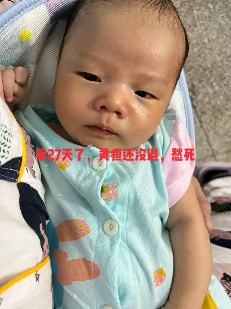 新生儿第7天黄疸21mg/ddl算高吗？需要立即治疗吗？-第2张图片-郑州医学网