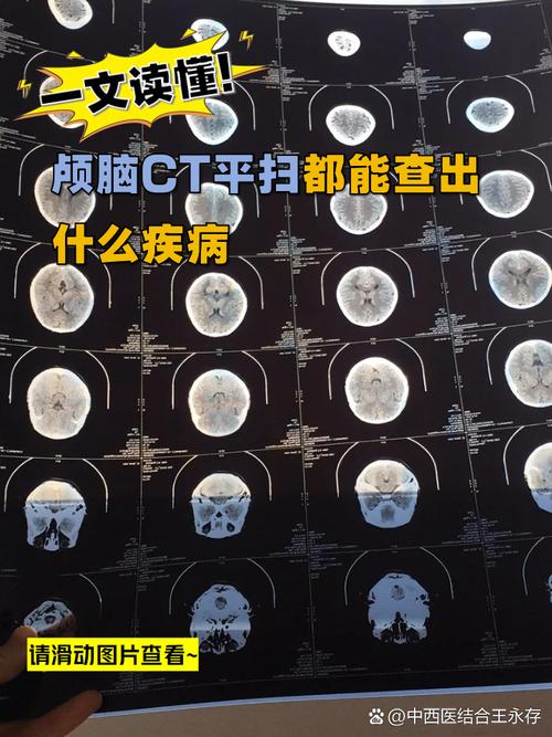 儿童做脑CT检查真的安全吗？辐射对身体会有哪些潜在危害？-第2张图片-郑州医学网