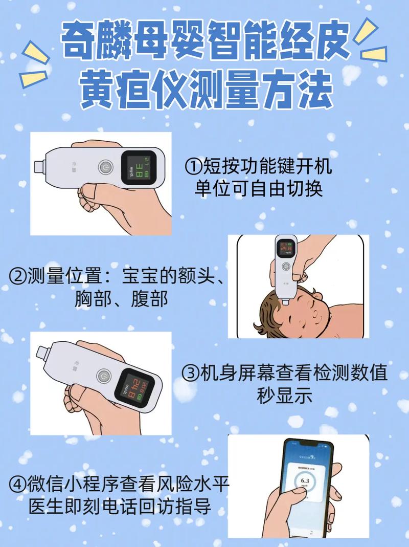 新生儿黄疸数值多少算异常?不同日龄宝宝黄疸标准有何区别?-第2张图片-郑州医学网 新生儿黄疸数值多少算异常?不同日龄宝宝黄疸标准有何区别?-第2张图片-郑州医学网