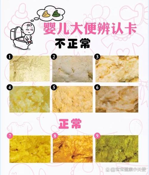 新生儿宝宝便便次数少-第3张图片-郑州医学网