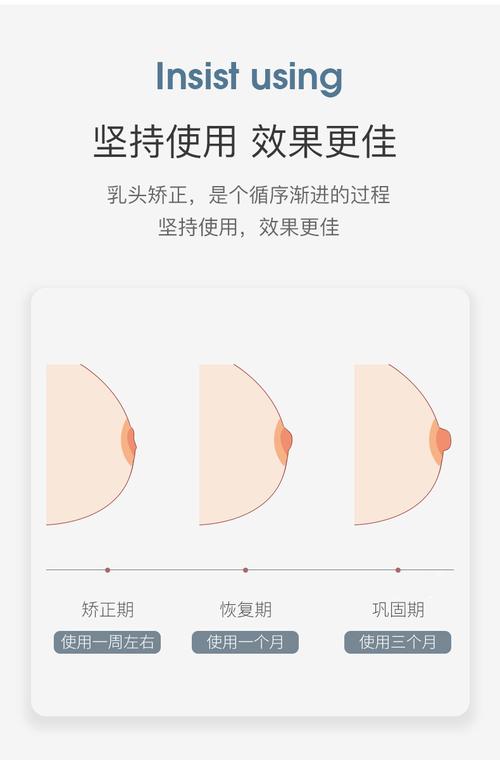 孕期乳头内陷不干预会影响哺乳吗？矫正方法安全吗？-第3张图片-郑州医学网