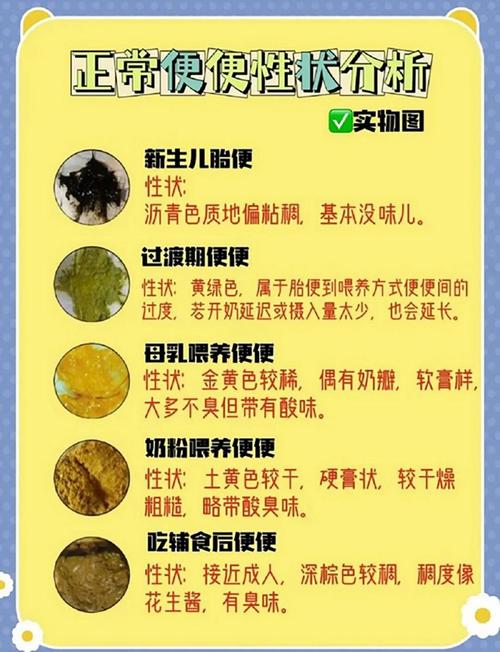 新生儿一天拉多少次大便算正常？颜色性状异常怎么办？-第1张图片-郑州医学网