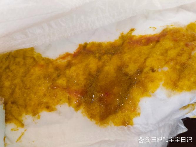 新生儿便秘大便带血丝是肛裂还是肠道问题？家长该如何应对与护理？-第3张图片-郑州医学网