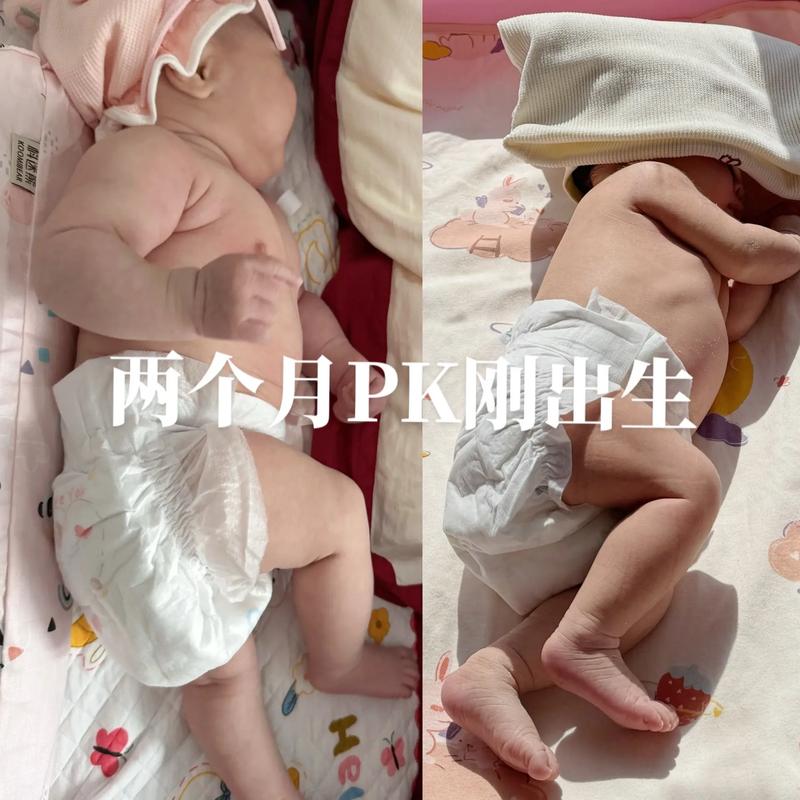 新生儿可以靠在腿上吗-第3张图片-郑州医学网