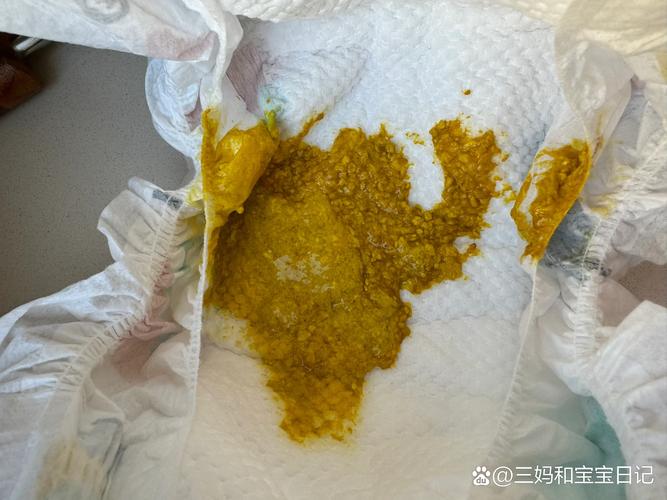 新生儿大便干燥肚子硬，是上火还是消化出了问题？-第3张图片-郑州医学网