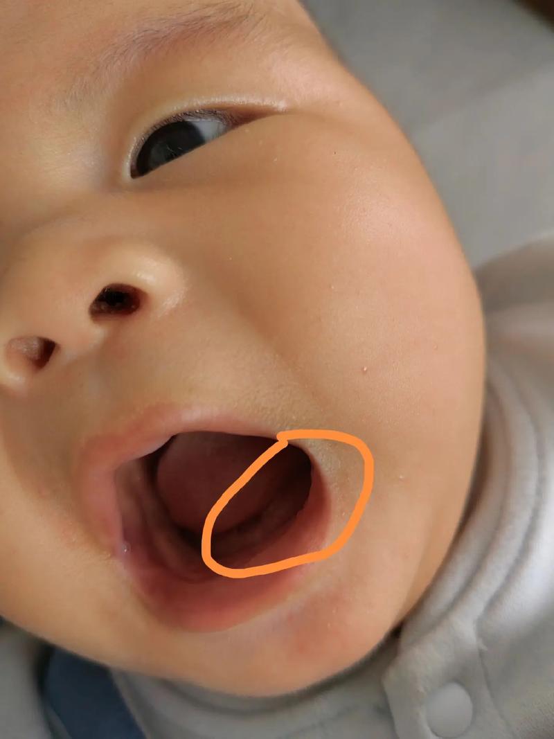 新生儿舌头总是往上翘是正常现象还是异常信号?需要干预吗?-第2张图片-郑州医学网 新生儿舌头总是往上翘是正常现象还是异常信号?需要干预吗?-第2张图片-郑州医学网