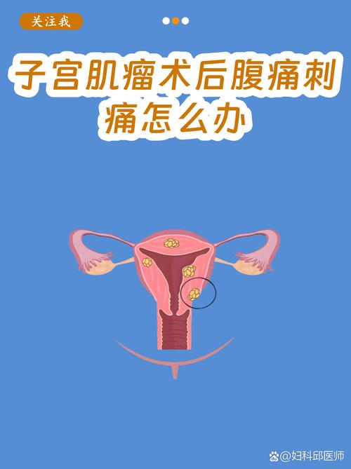 孕期子宫肌瘤引发腹痛，会对胎儿有影响吗？该如何科学应对？-第3张图片-郑州医学网