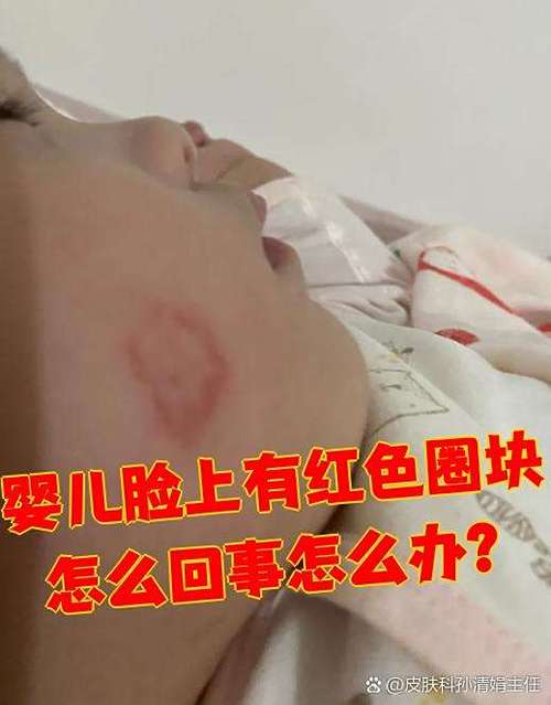 新生儿血液感染炎症为何高发?如何科学预防与守护健康?-第3张图片-郑州医学网 新生儿血液感染炎症为何高发?如何科学预防与守护健康?-第3张图片-郑州医学网