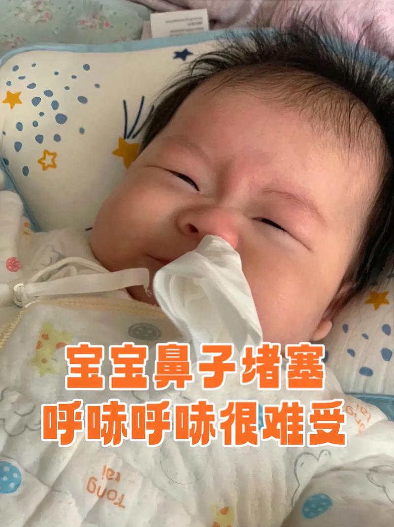 新生儿鼻子呼啦呼啦的，是感冒了还是鼻塞？要怎么处理才好？-第1张图片-郑州医学网