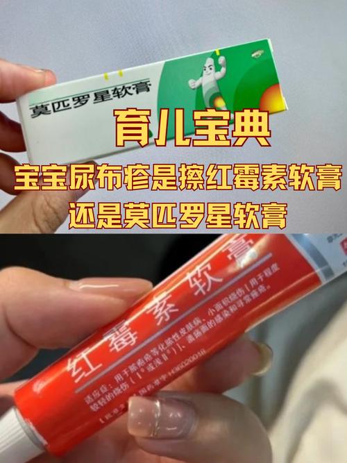 新生儿痤疮能用酮康唑乳膏吗？安全性与使用方法需注意什么？-第3张图片-郑州医学网