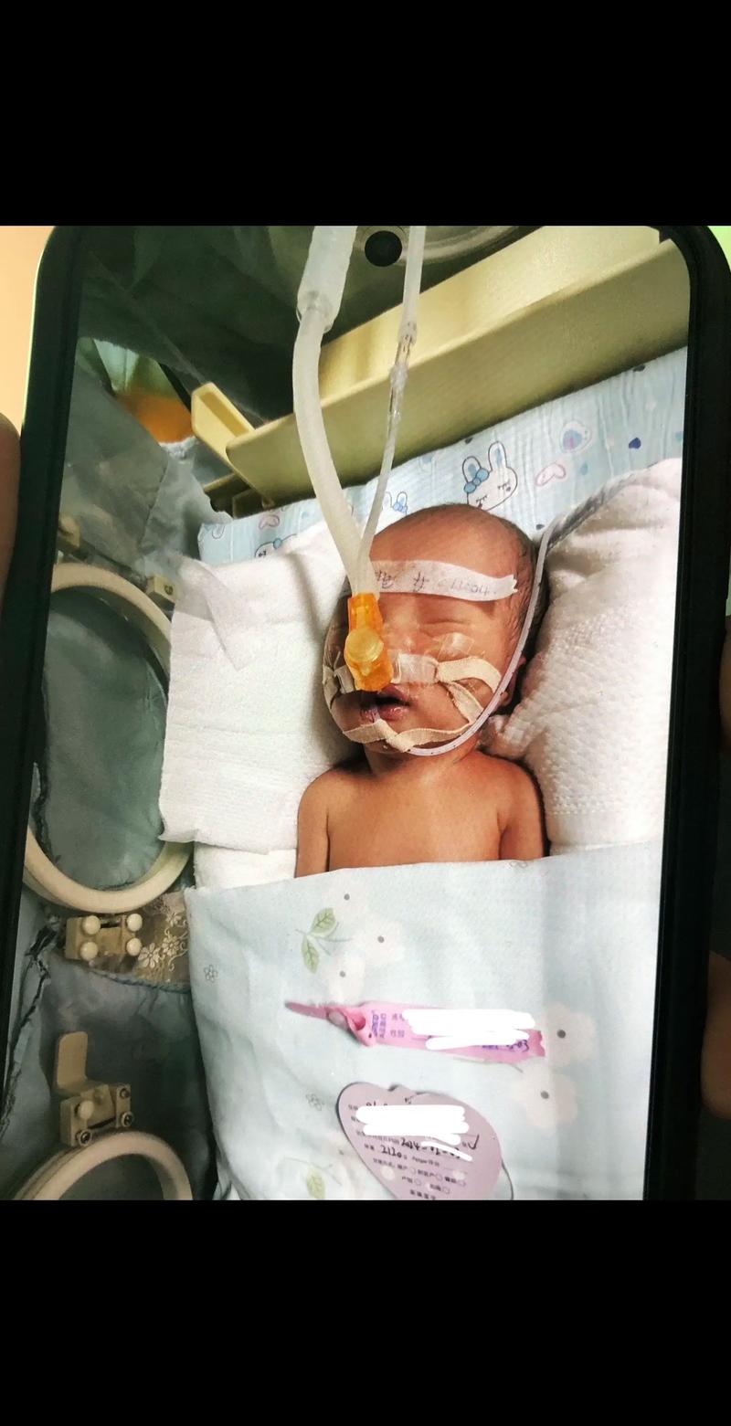 36周早产儿患肺炎，该如何科学护理才能降低风险？-第2张图片-郑州医学网