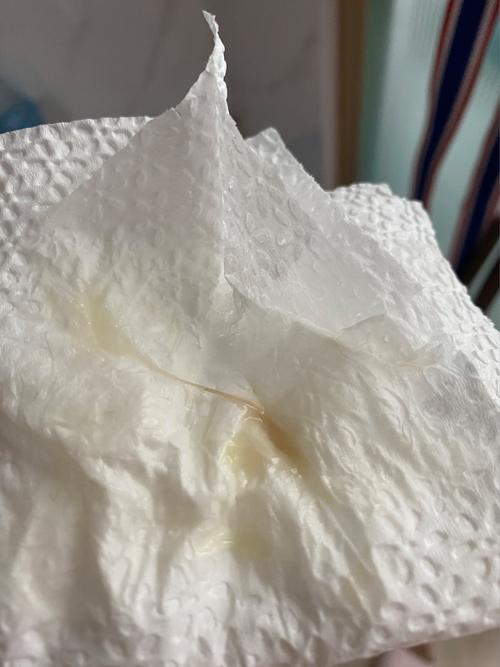 怀孕期间白带是咖啡色-第1张图片-郑州医学网